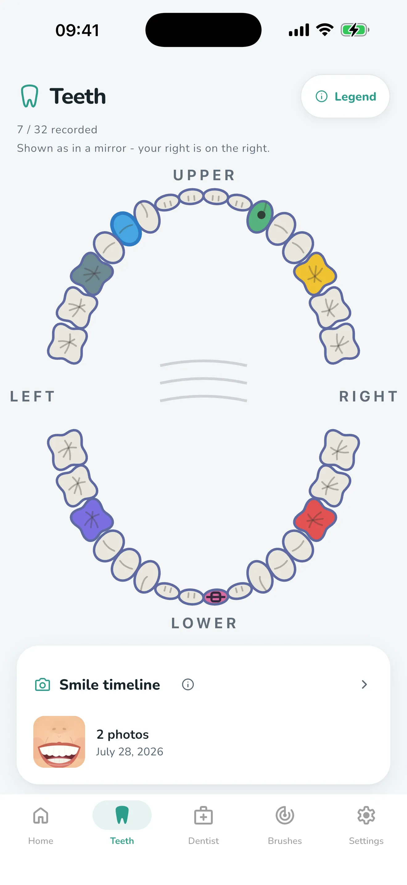 A tooth map with a filling, a crown, an implant and braces recorded in colour
